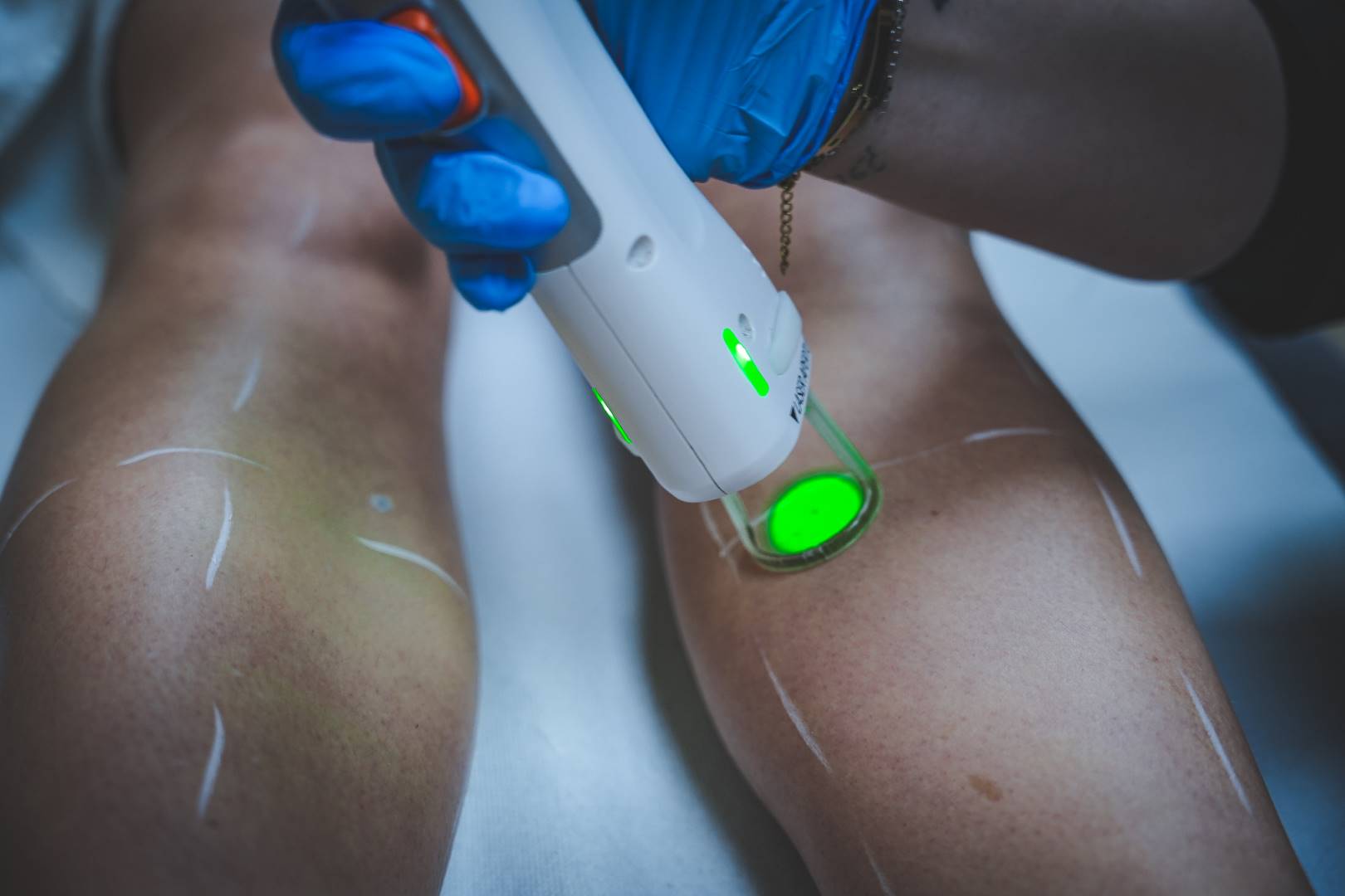 Épilation électrique