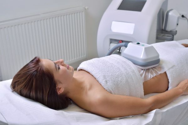 Séance de coolsculpting